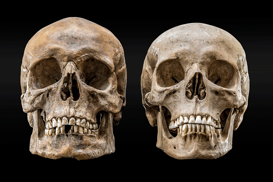 Frontalansicht von zwei menschlichen Schädeln. 